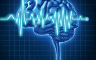 Electroencephalography – Brain Mapping – Sleep Studies